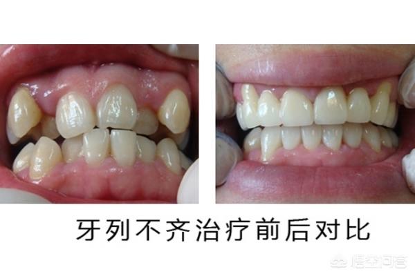 台州最新24小时牙医在线咨询方法分析(最方便真实的台州有没有24小时牙医方法)