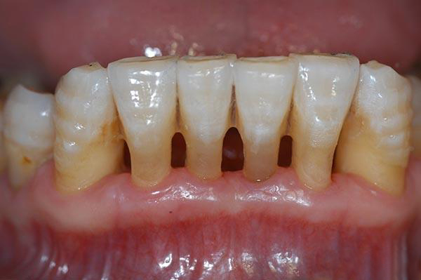 台州最新24小时牙医在线咨询方法分析(最方便真实的台州有没有24小时牙医方法)